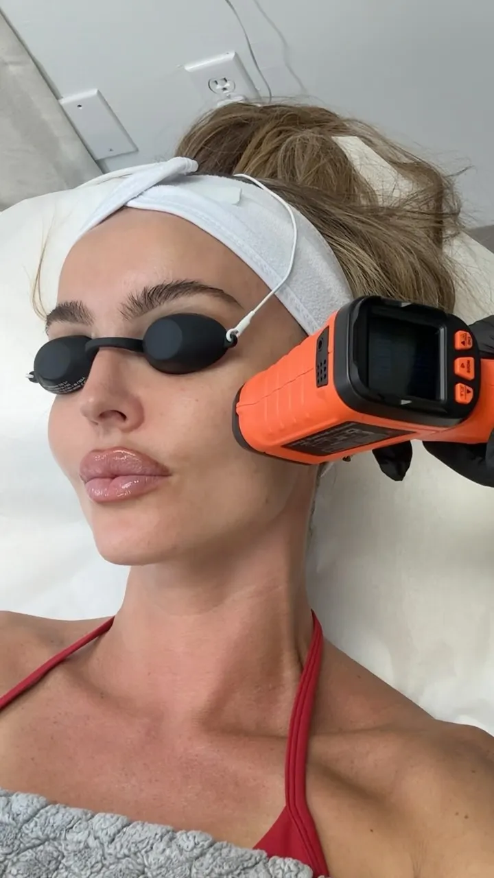 You’ve been told lasers = downtime. This one doesn’t ⚡️
.
Laser Genesis with NP @skinbysogol
.
📍 Skin Spa New York, Mi